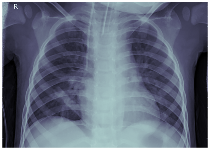 Machine Learning in Medical Diagnostics 5