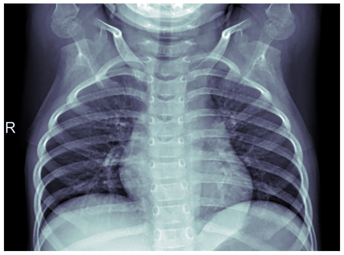 Machine Learning in Medical Diagnostics 4