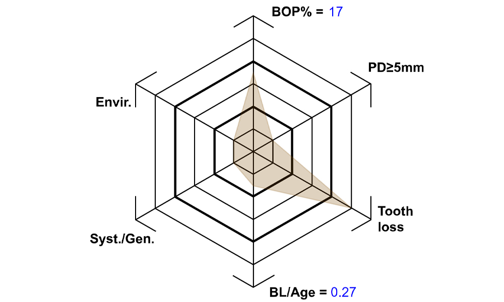 Schematic representation of the case-specific patient profile created by considering both general medical and intraoral health. According to Lang & Tonetti. Schematic representation of the case-specific patient profile created by considering both general medical and intraoral health. According to Lang & Tonetti.