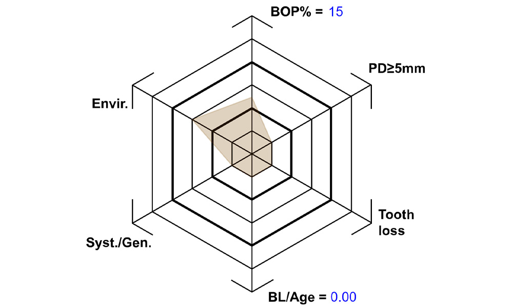 Schematic representation of the case-specific patient profile created by considering both general medical and intraoral health. According to Lang & Tonetti. Schematic representation of the case-specific patient profile created by considering both general medical and intraoral health. According to Lang & Tonetti.