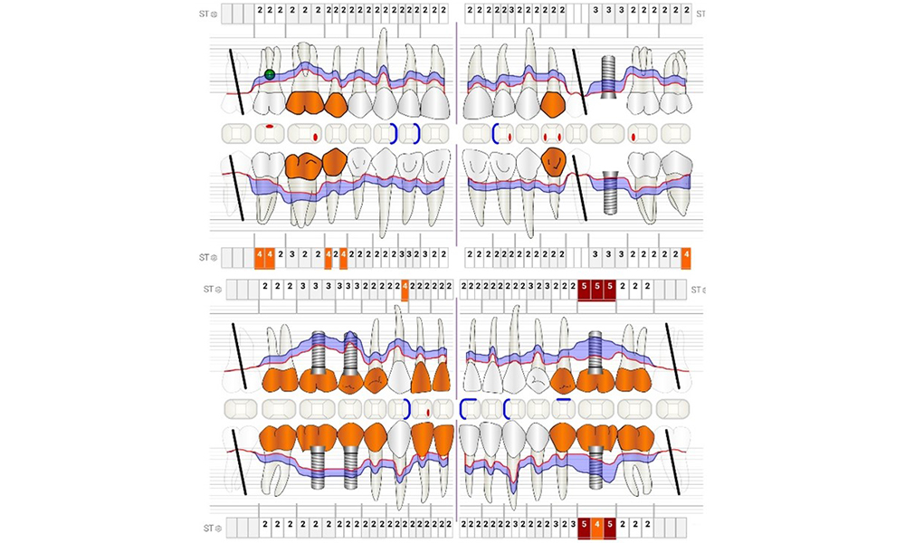Periodontal status (ParoStatus®.de) Periodontal status (ParoStatus®.de)