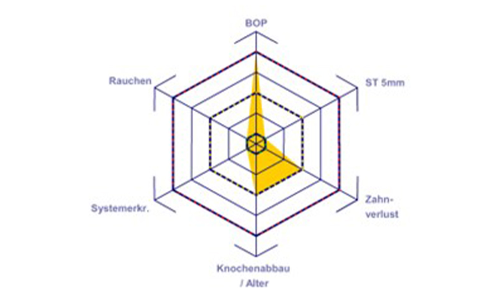 Periodontal risk assessment according to Lang and Tonetti: medium risk Periodontal risk assessment according to Lang and Tonetti: medium risk