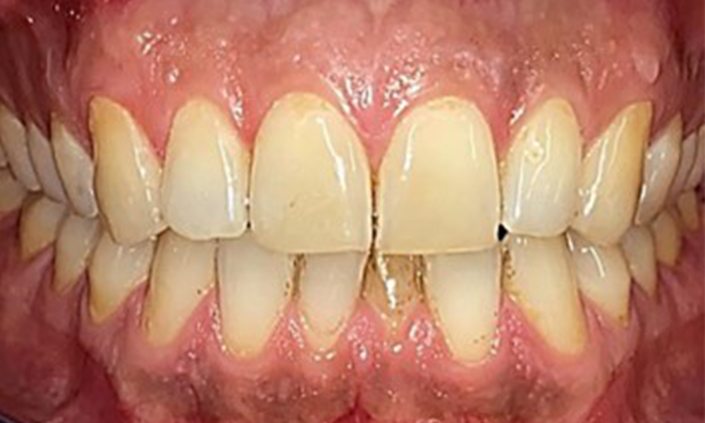 Frontal view Frontal view