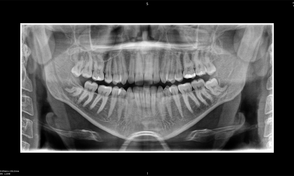 Abbildung e: Bildgebungsergebnisse von Seethrough Max vor einem schwarzen Hintergrund. Abbildung e: Bildgebungsergebnisse von Seethrough Max vor einem schwarzen Hintergrund.