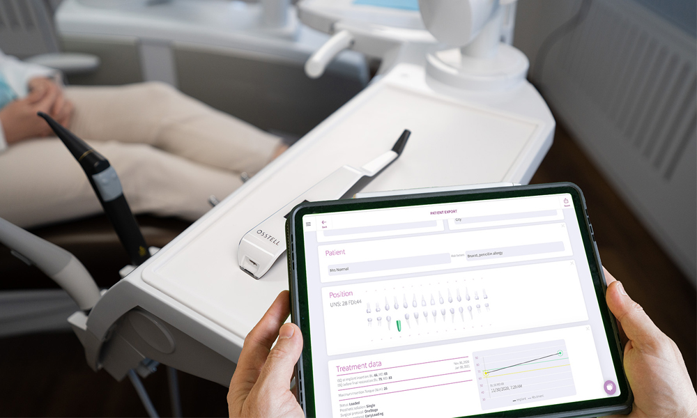 Osstell – das Original mit über 1.300 Publikationen Osstell – das Original mit über 1.300 Publikationen