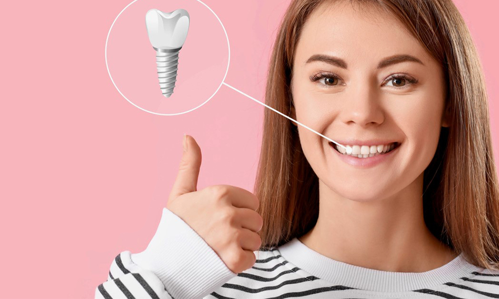 Implants - Une réussite aussi du point de vue des patients ? Implants - Une réussite aussi du point de vue des patients ?
