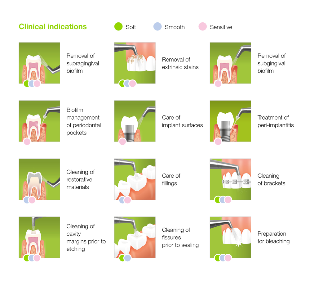 Fig. 2: Easy Prophylaxis Guide: An overview of the indications and powders. Fig. 2: Easy Prophylaxis Guide: An overview of the indications and powders.