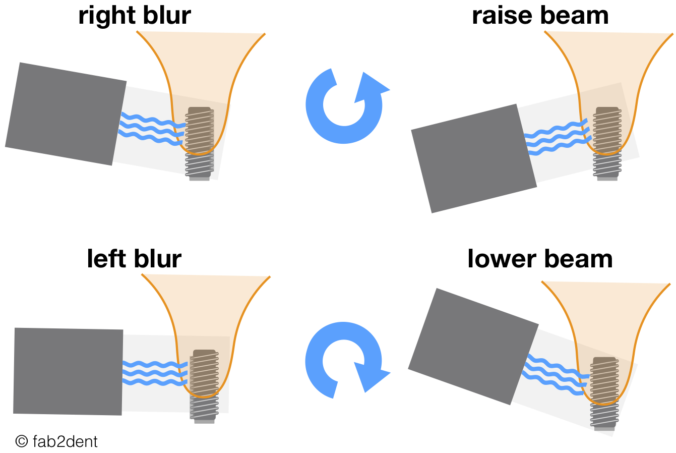 Gute Röntgenbilder von Implantaten leicht gemacht! (Shutterstock) Gute Röntgenbilder von Implantaten leicht gemacht! (Shutterstock)