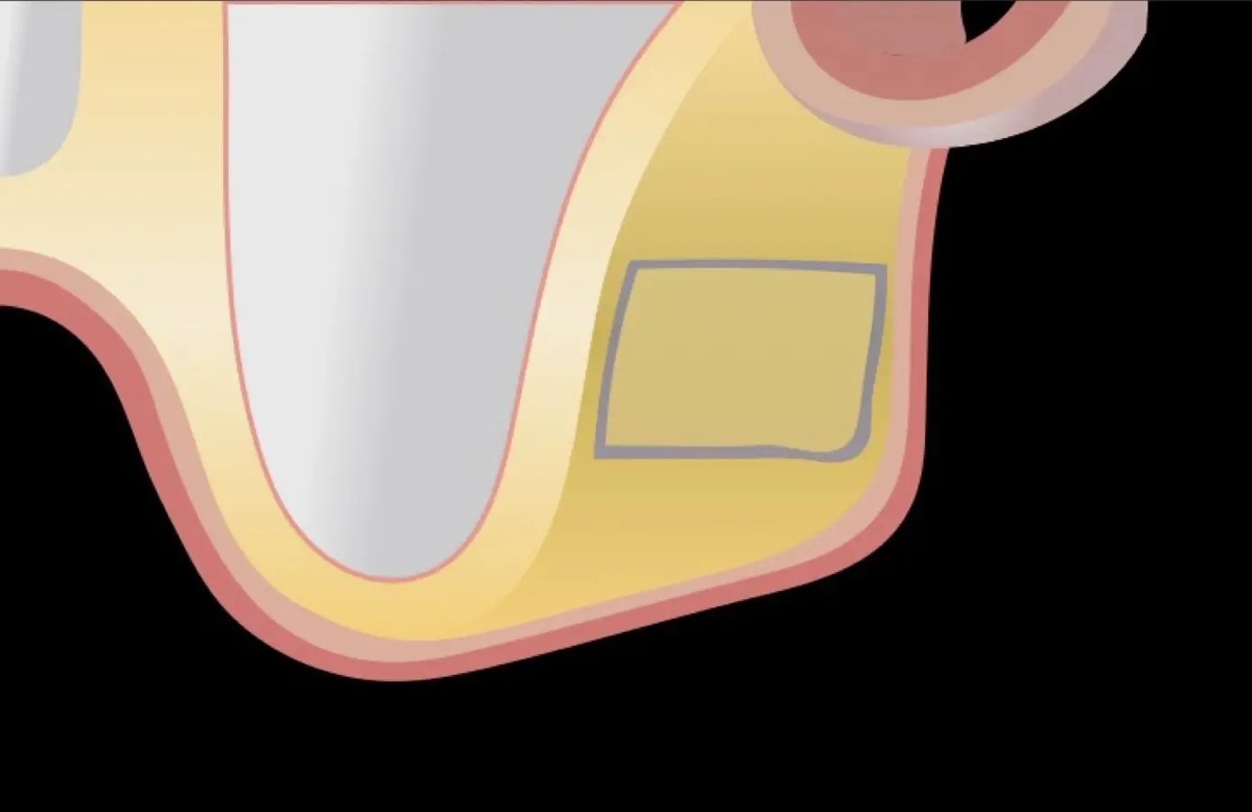 Diseño rectangular de la ventana lateral. Diseño rectangular de la ventana lateral.