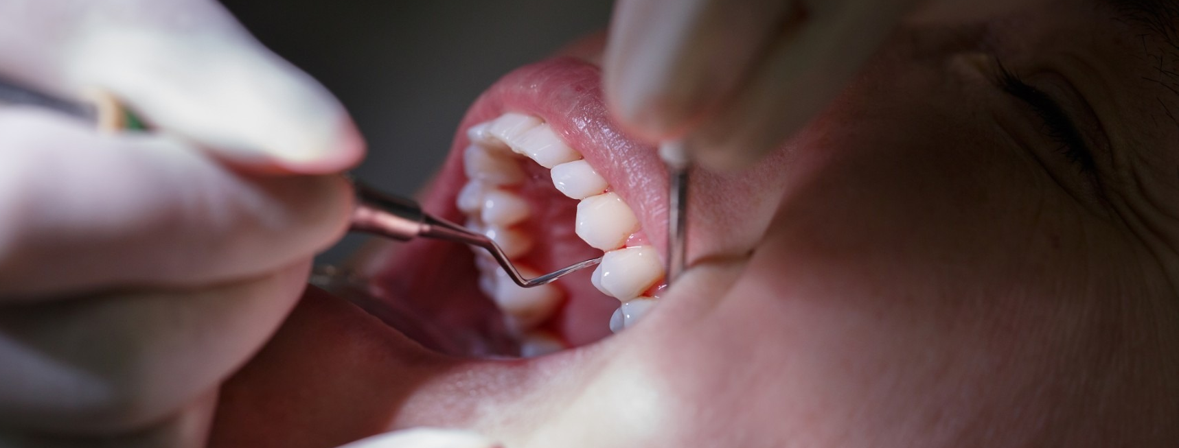 Periodontal treatment in patients with diabetes – what do you need to know? Periodontal treatment in patients with diabetes – what do you need to know?