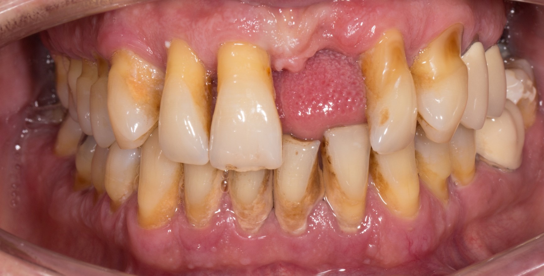 Classification of clinical periodontal health Classification of clinical periodontal health