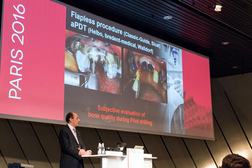 Dr. Jörg Neugebauer proporcionó conocimientos especializados sobre el flujo de trabajo para la colocación del implante y sobre métodos de tratamiento cuando se producen complicaciones. Dr. Jörg Neugebauer proporcionó conocimientos especializados sobre el flujo de trabajo para la colocación del implante y sobre métodos de tratamiento cuando se producen complicaciones.