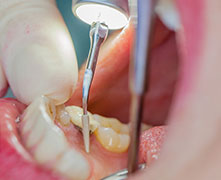 Пиезо скалер Tigon+ Пиезо скалер Tigon+