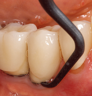 Fig. 8 Fig. 8