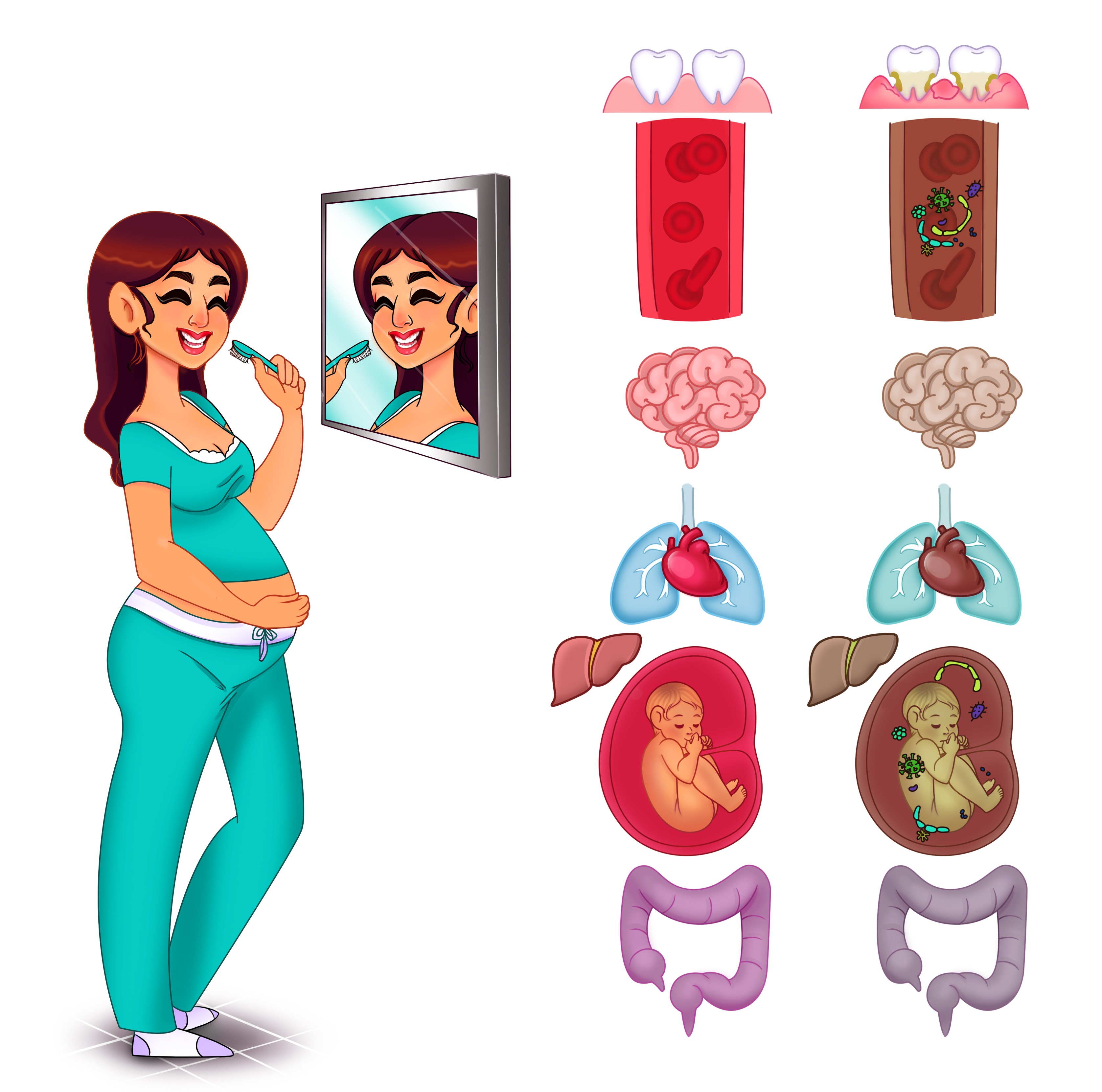 Treating periodontal disease during pregnancy Treating periodontal disease during pregnancy