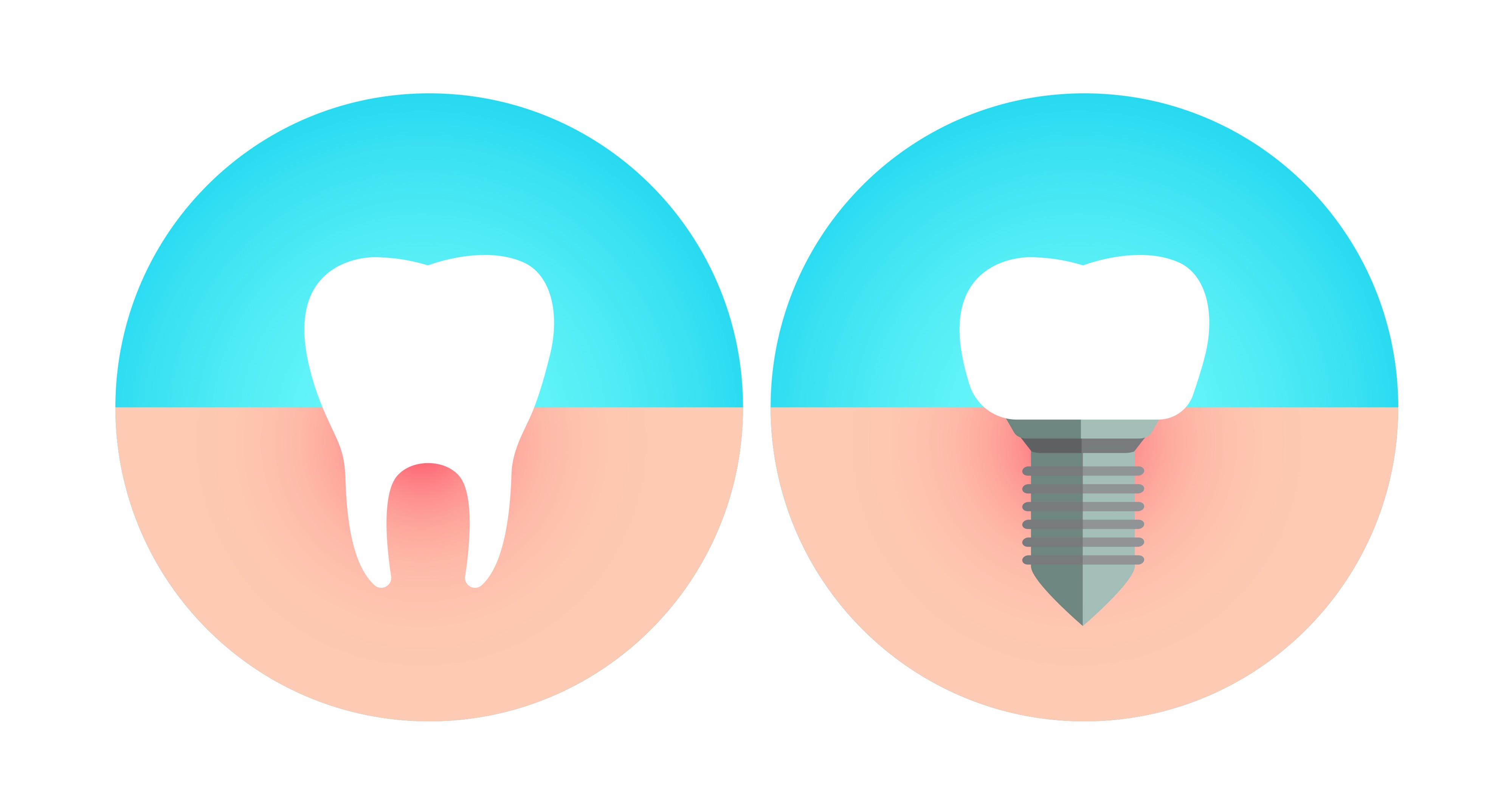 Mucositis & gingivitis – are they comparable? Mucositis & gingivitis – are they comparable?