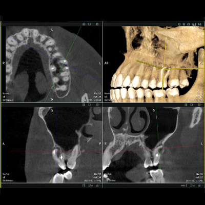 Imaging results of Seethrough Max, in front of a black background. Imaging results of Seethrough Max, in front of a black background.