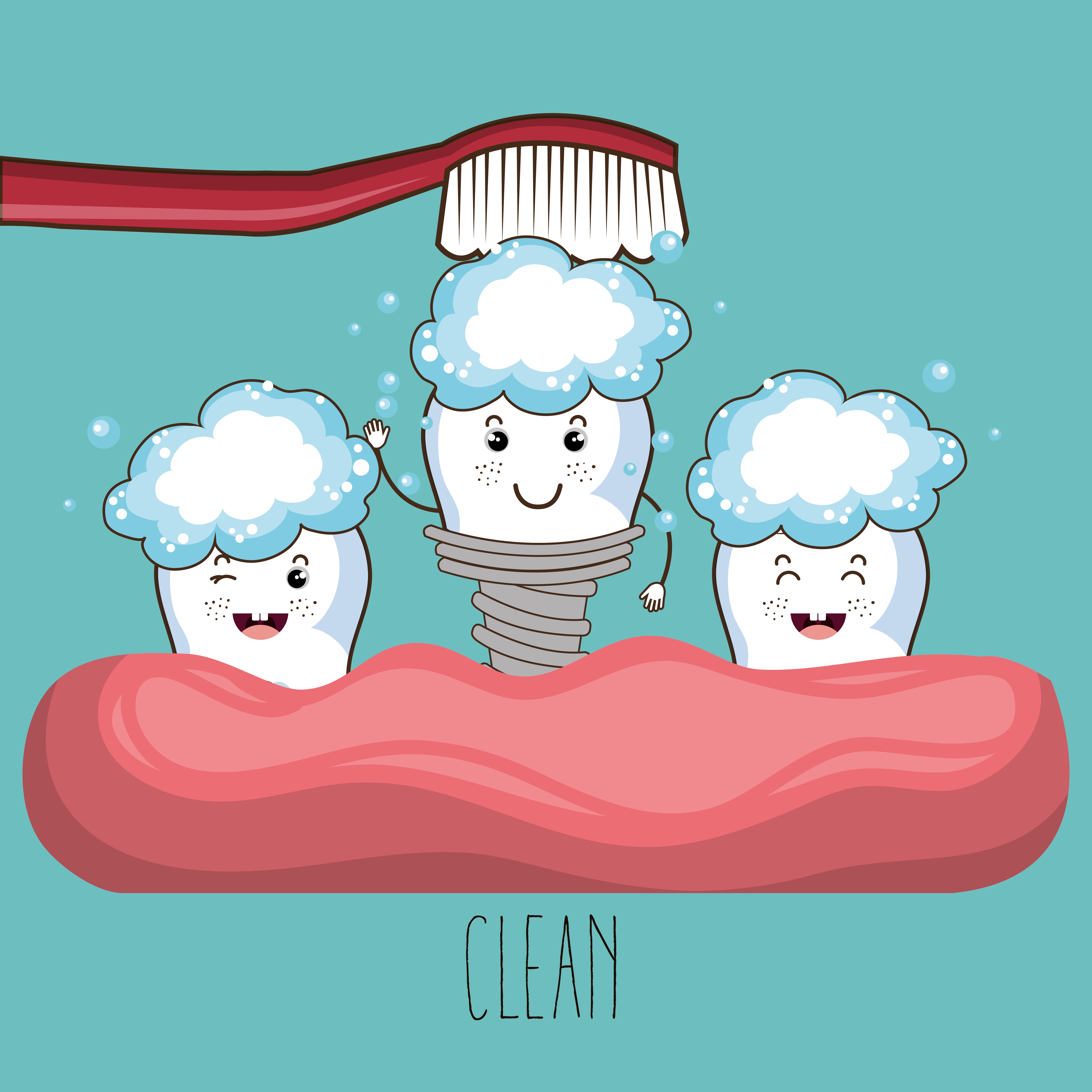 Is implant maintenance important? Is implant maintenance important?