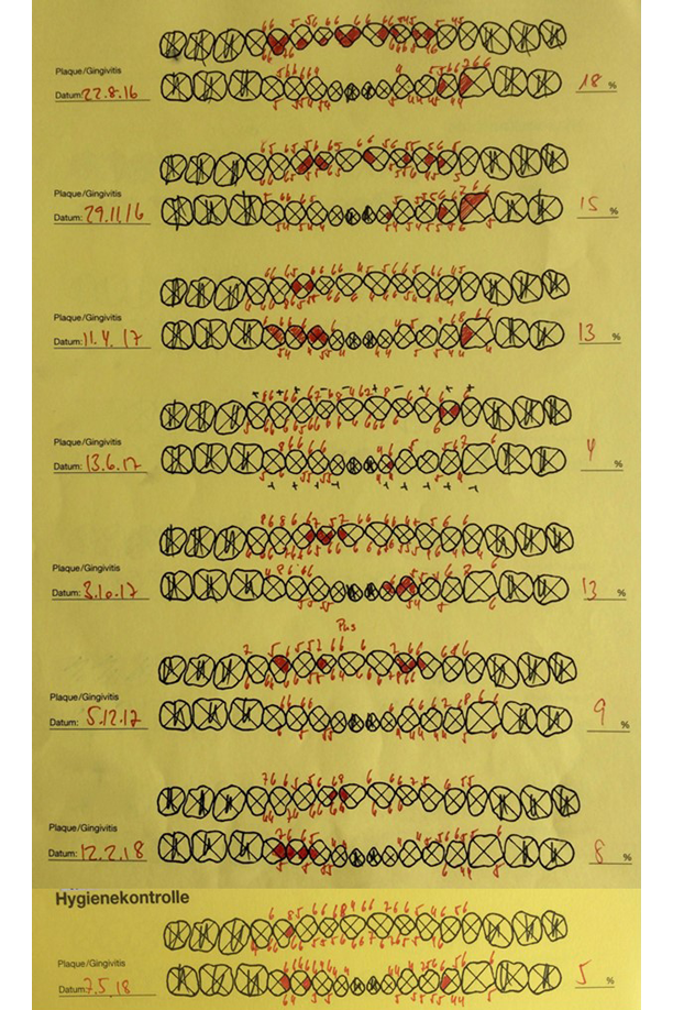 The BOP ratio has decreased considerably since August 2016. The BOP ratio has decreased considerably since August 2016.