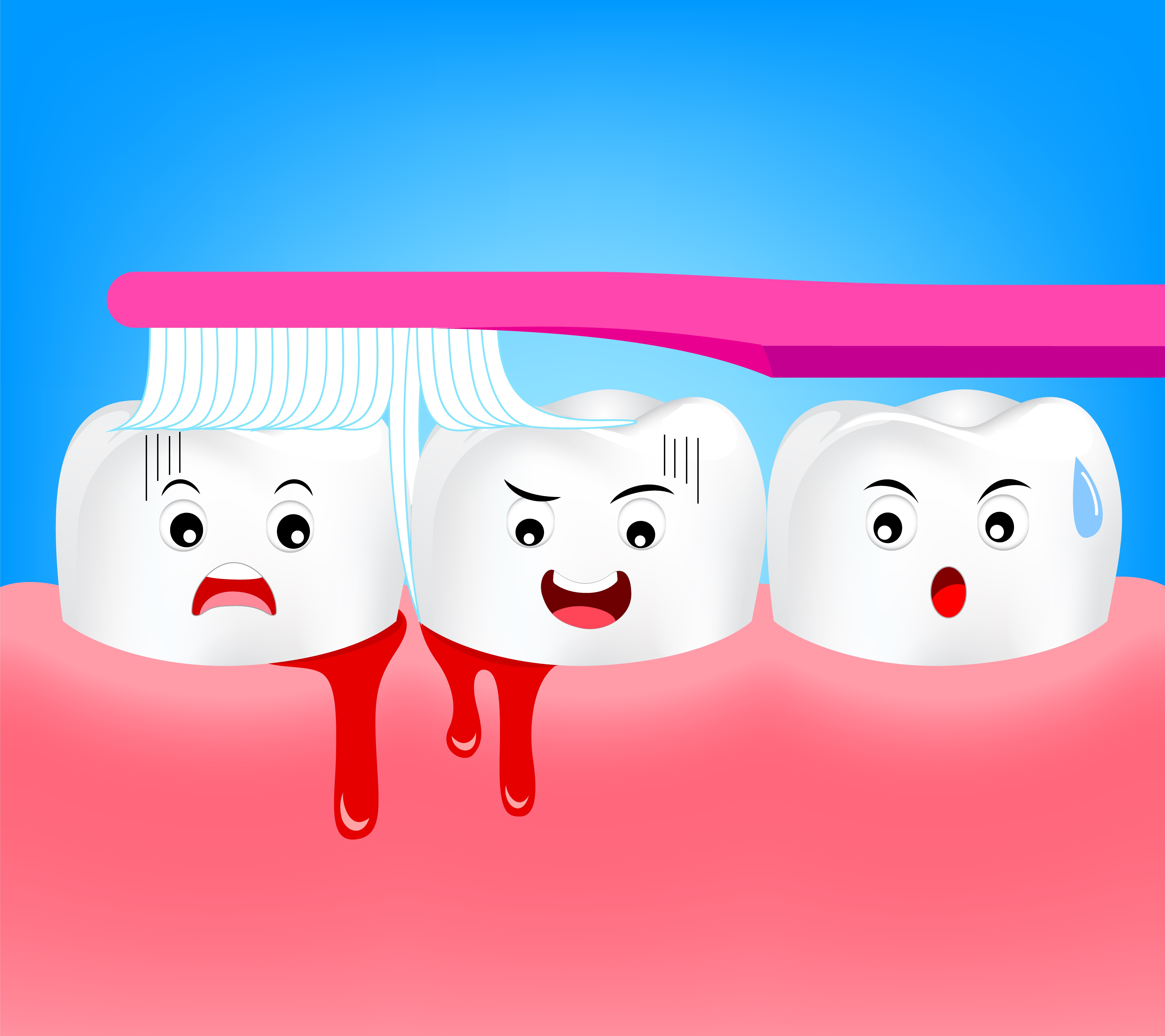 Classification of gingivitis (Shutterstock) Classification of gingivitis (Shutterstock)