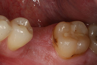 Initial clinical situation Initial clinical situation