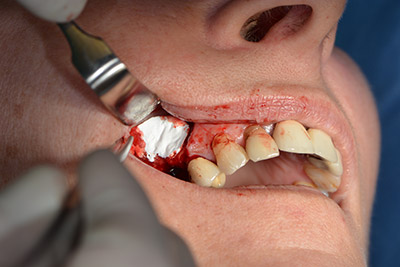 Implantology Implantology