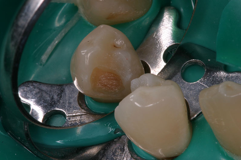 sin Proface* sin Proface*