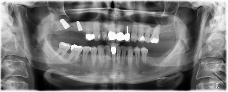 Orthopantomogram Orthopantomogram