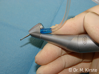 WS-91 LG de W&H WS-91 LG de W&H