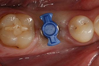 conformación conformación