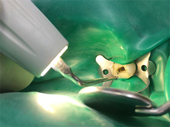 Strumento piezoelettrico 4E Strumento piezoelettrico 4E