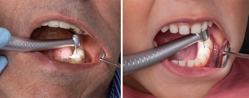 TK-94 W&H Microturbine TK-94 W&H Microturbine