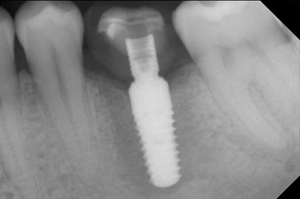x-ray check x-ray check