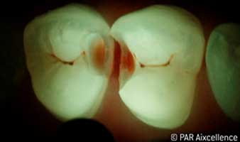 Fig. 4: Image as in Figure 3 - this time using Facelight Fig. 4: Image as in Figure 3 - this time using Facelight