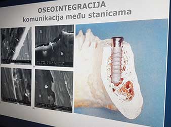 Osseointegration Osseointegration
