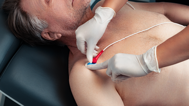 ECG