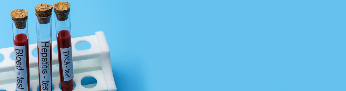 Het hepatitis-virus kent drie varianten: hepatitis A, B en C.