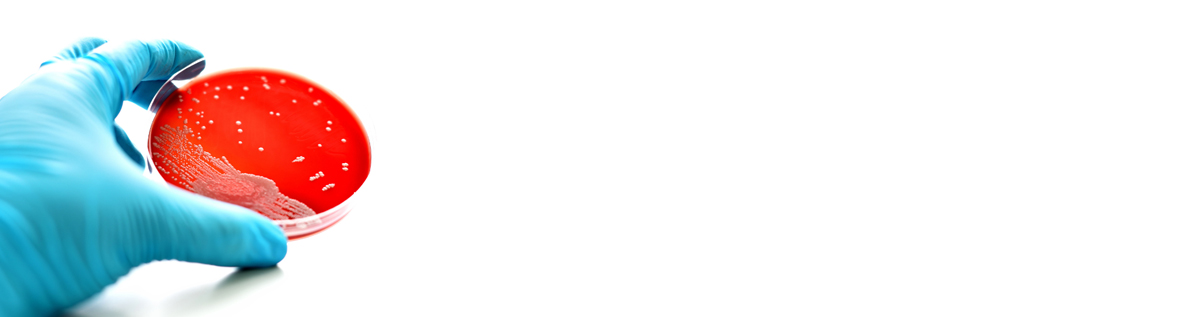 Gonorroe, ook wel druiper genoemd, is een zeer besmettelijke soa die na chlamydia het vaakst voorkomt in Nederland.