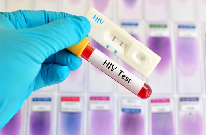 HIV-test.