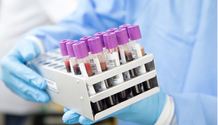 Afhankelijk van het ziektebeeld en de klachten die je ervaart, kan de (huis)arts je medicijnen voorschrijven.