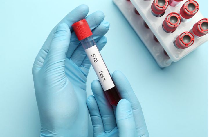 Nieuw chlamydia-testbeleid.