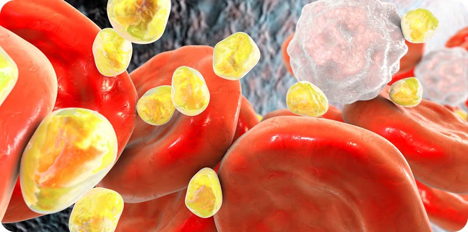 Een te hoog cholesterol betekent dat er te veel vetdeeltjes in het bloed zitten.