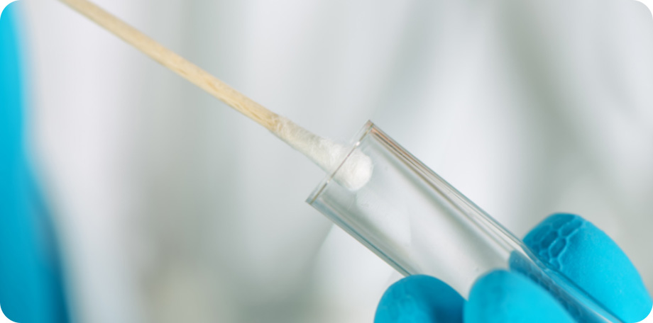 Als je last hebt van soa-symptomen is het belangrijk om snel een soa-test te doen en je eventueel te laten behandelen.