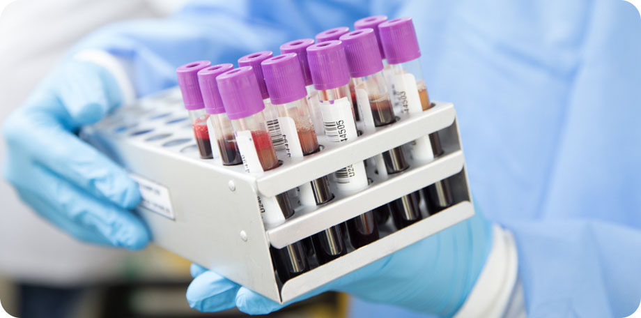 Als je zelf geen hiv hebt, maar wel een verhoogd risico loopt om het te krijgen, kun je PrEP gebruiken om hiv te voorkomen.