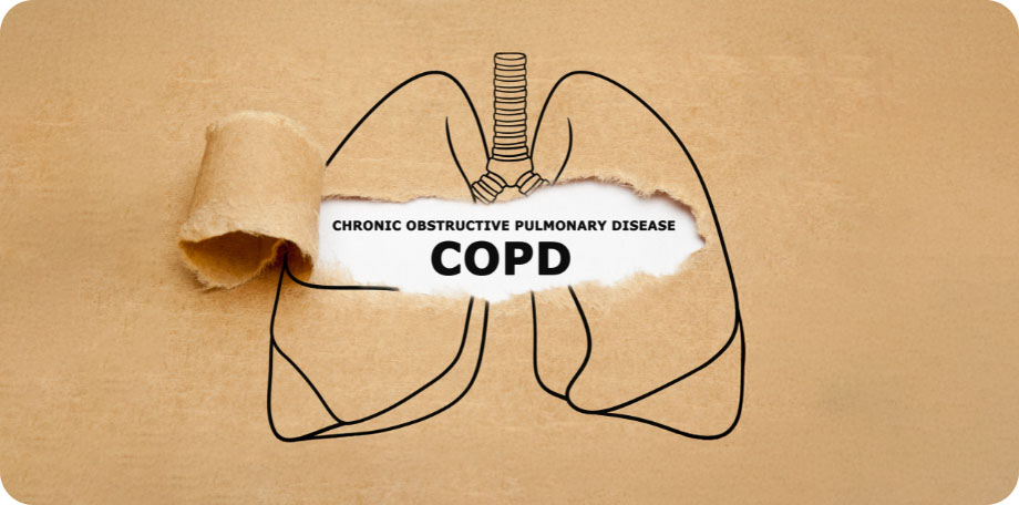 COPD is een ernstige aandoening, maar de levensverwachting verschilt van persoon tot persoon.