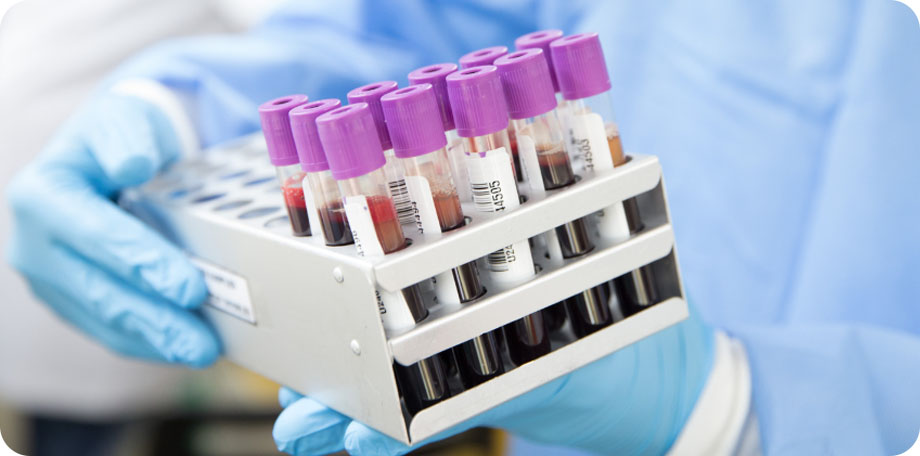 Voor betrouwbare chlamydia-testen, zorg en medicijnen kun je terecht bij Soapoli-online en Nationale Apotheek.