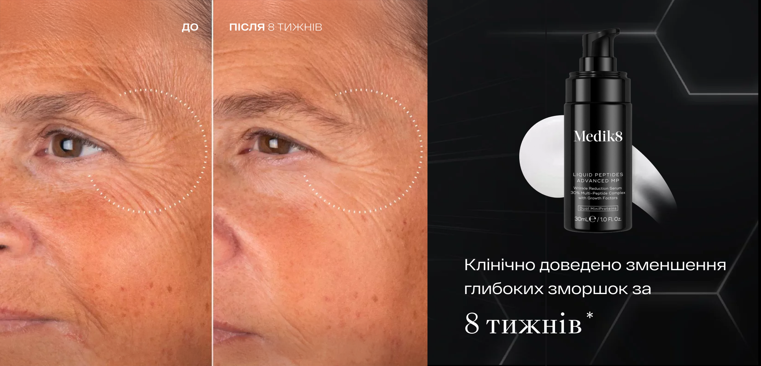 before_after_2424-1165.png