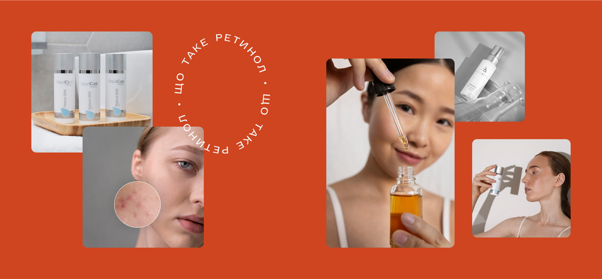 Усе, що ви хотіли знати про ретинол (Фото-5)