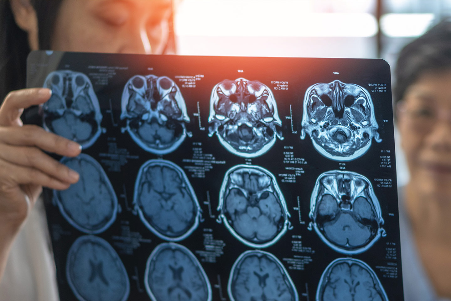 Photo of health workers looking at an Xray scan of a human brain