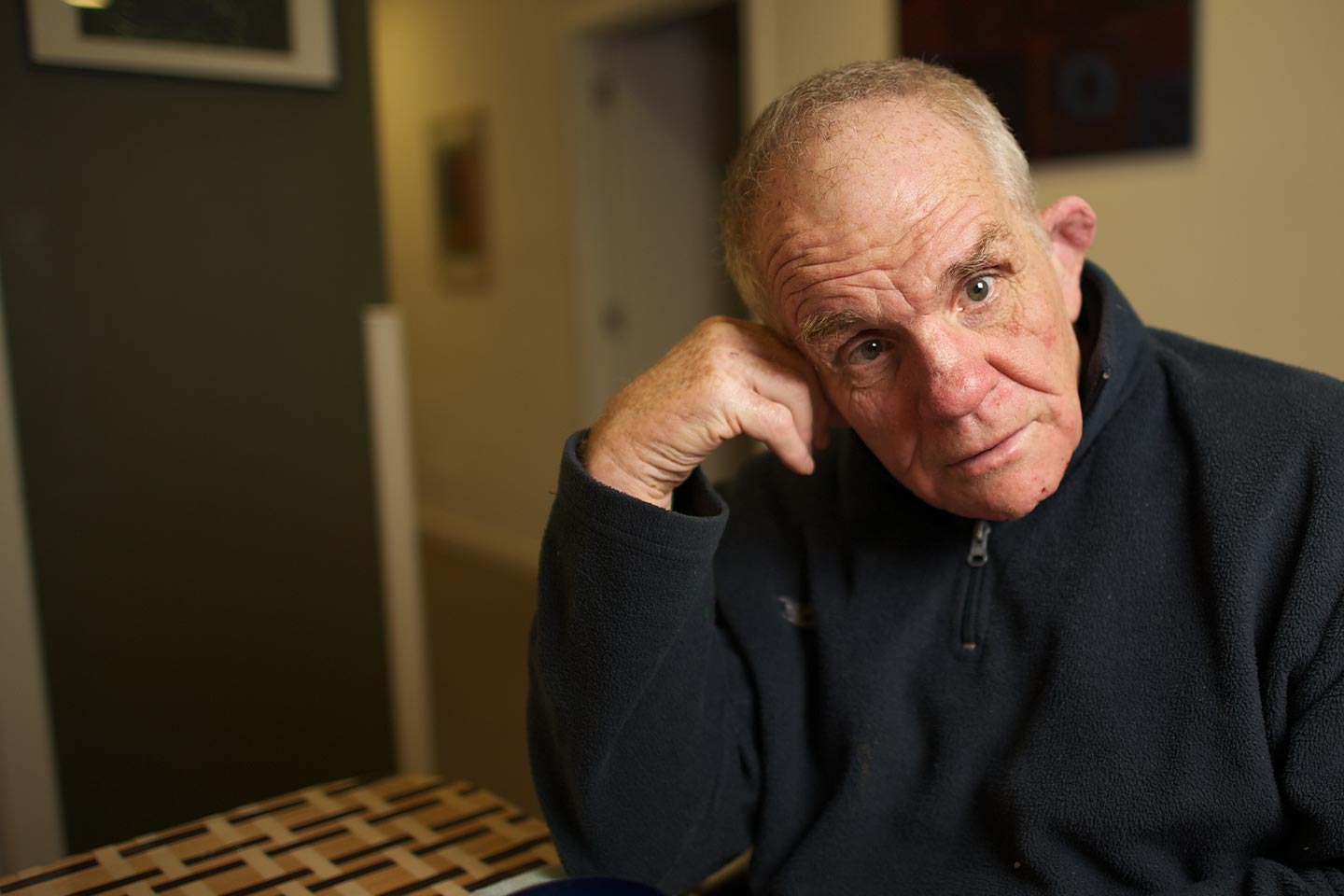 Photo of a man in a dark jacket leaning his head on his hand